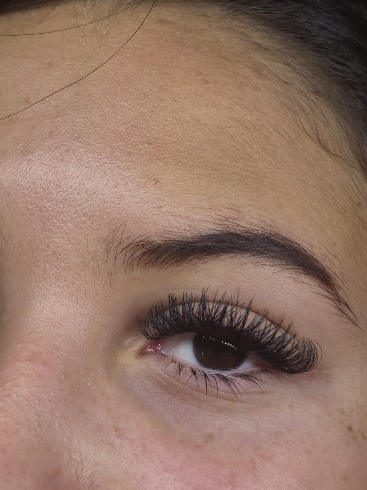 Antes